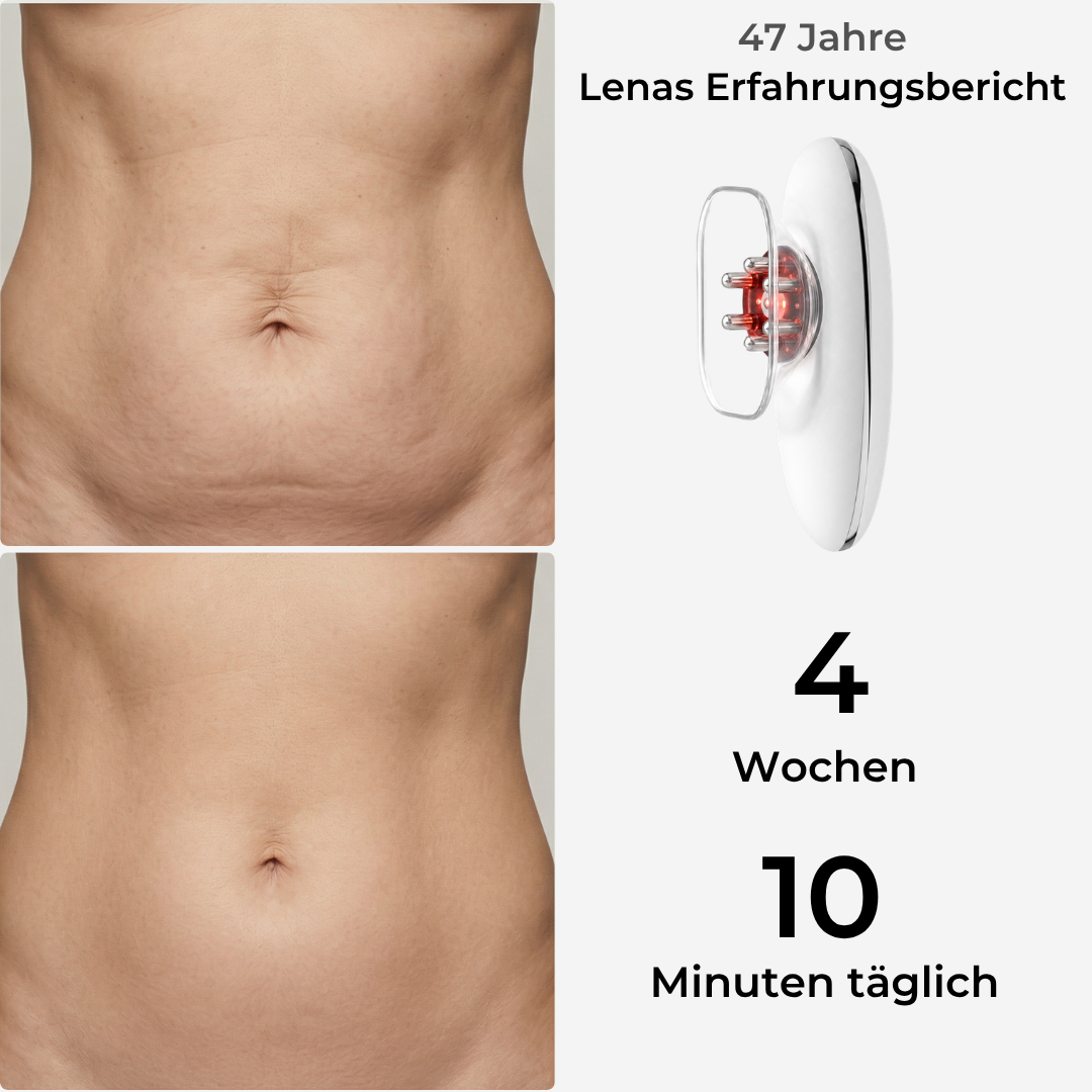 Anti-Cellulite Gerät - Straffung mit Vakuum, EMS & LIPO