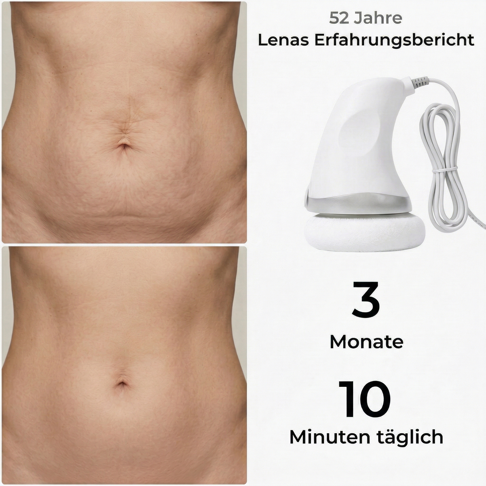 BodyLift Pro 2.0 – Die neue Generation der Hautstraffung